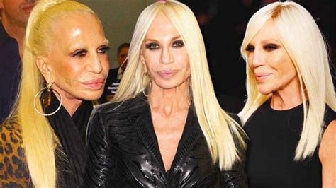 donatella versace ora|donatella versace face what happened.